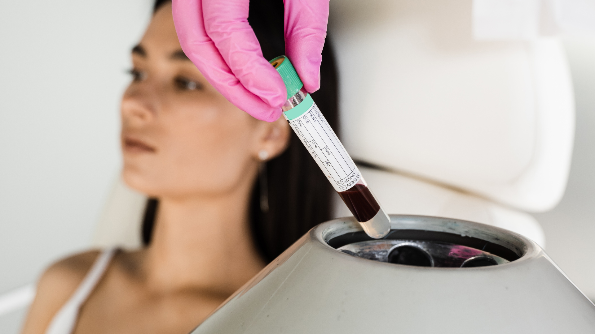 Centrifugado de la muestra de sangre para obtener plasma rico en plaquetas facial